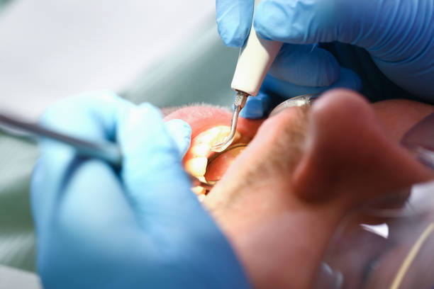 Best Emergency Treatment for Toothache in Franklin Park, FL